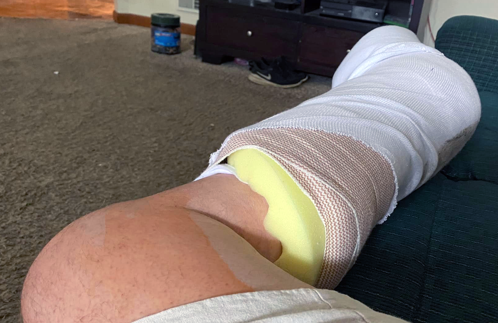 Exhausted Alberth lying down and showing off his bandaged leg