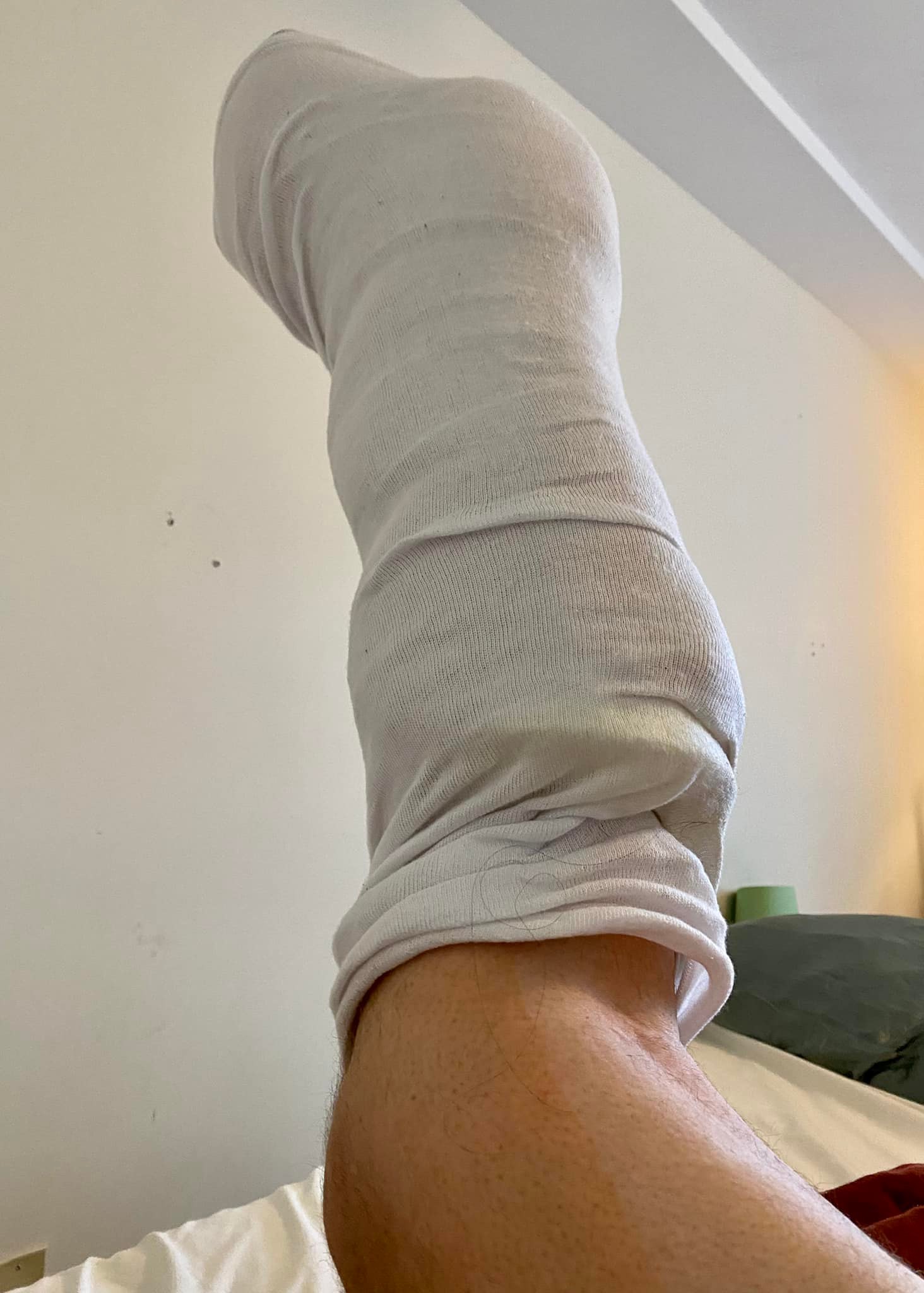 Bandaged leg, raised up to the sky